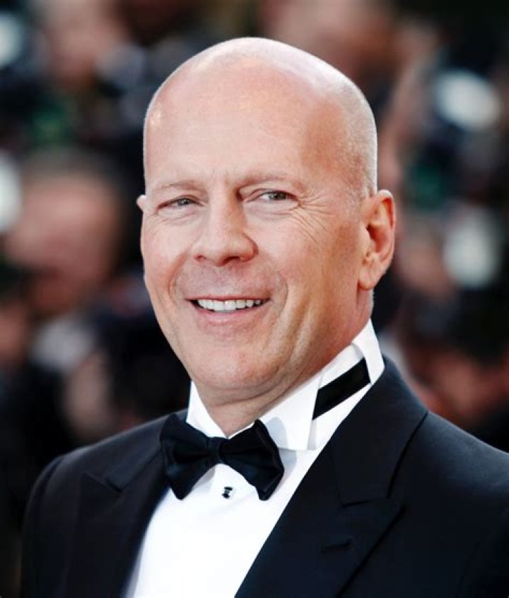 Why is Ned bald? - Celebrity.tn